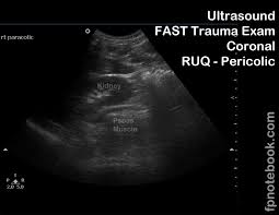 Image result for FAST Exam