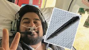 Stingray attack: Hawke's Bay man's survival story after serrated barb  leaves him critically injured