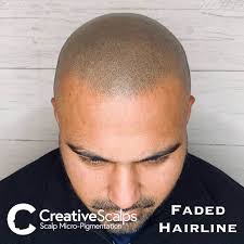 Check spelling or type a new query. Hairline Tattoo Scalp Micropigmentation Hairline Creative Scalps