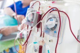Withdrawing dialysis, the patient will become more and more uremic and the end will be within if i could give my opinion on the biggest factors on determining how long you live on dialysis is following the dialysis regime. All You Need To Know About Dialysis Narayana Health