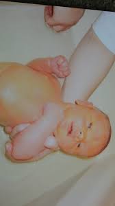 jaundice in neonates better safer care