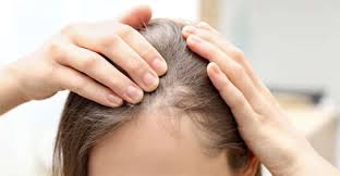 زراعة الشعر للنساء في تركيا بدون حلاقة للشعر 2024 | دليل كلينك