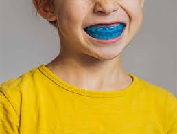 Myobrace In Dubai Silicon Oasis - Get Your Child Teeth Straight