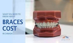 1 of transparent aligners for thousands of dentists and orthodontists. Braces Cost In Canada And Orthodontic Insurance Explained