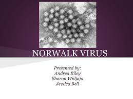 Get tested, stay home, and isolate yourself. Cs2 Norwalk Virus Powerpoint Presentation