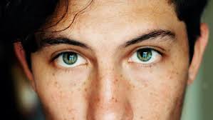 Como Eliminar Las Marcas De Acne De La Cara