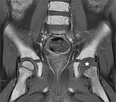 They may also be called enterprise networks if they connect all networks within an organization. Mr Imaging Of Pediatric Bone Marrow Radiographics