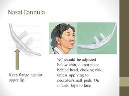 Our research stemmed from the outstanding research from the recently published article study shows oxygen less functional when nasal cannula worn as headband. Oxygen Devices Rt 210a Oxygen Devices Ppt Download