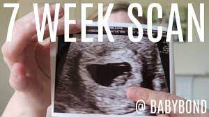 Yes, one of the primary reasons for a dating scan at 7 weeks is to count how many gestational sacs and. Early Pregnancy Scan At 7 Weeks Babybond Youtube