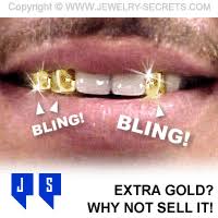 If you are an individual who wants to sell your gold teeth or a dentist's office looking to get rid of dental scraps, you can get your estimate today. There S Gold In Them There Teeth Jewelry Secrets