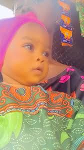 What can I use to treat my baby's neck rash?