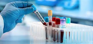 Klinik mediviron bukit jalil is a klinik based in bukit jalil, kuala lumpur. Blood Test Klinik Mediviron Puchong Avenue We Care For Your Health