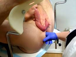 Prostatamassage auf dem Frauenarztstuhl!