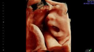 The baby also begins to make its first free movements, to move its legs and tiny fingers. Hd Live Ultrasound 4d 30 Weeks We Found Out The Gender Huge Surprise For Tyler Youtube