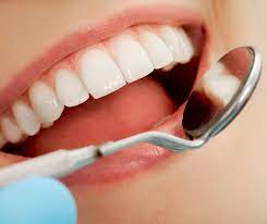 This isn't going to be a po. What To Know About Tartar Build Up And Your Teeth Snodgrass King
