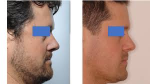 Welcome: Liset Maas-Houtekamer, Sarath Kumar, Altin Bebja, Katya Biondi,  Liang Chun Kuo, Paola Cingari, Dentman Ju-Hung Pan, AnaZoly Chudan,  Stephanie Martimbeau, 劉炯伶, Daniel Olsen, Dieg M PO, Arun Kumar B R, Mahesh