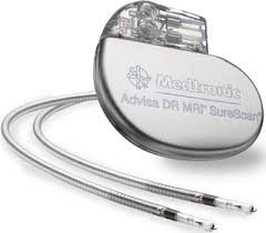 Modern pacemakers and implantable defibrillators provide a multitude of technical algorithms and parameters, which can be programmed individually and can treat different forms of arrhythmias. Medtronic S Pacemakers Now Cleared For Full Body Mri Compatibility Medgadget
