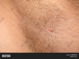 This may work as a great permanent armpit hair removal home remedy if used on a regular basis. Close Picture Unshaved Image Photo Free Trial Bigstock
