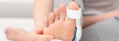 Image result for Hallux Varus