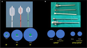 Neuroendoscopic access to the third ventricle in patients with narrow  foramen of monro without stenosis/obstruction: role of foraminoplasty