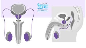 علت و علائم اختلال نعوظ در مردان چیست؟ • فیزیوتراپی بهروزی