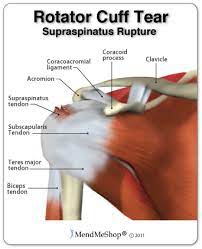 The shoulder joint (glenohumeral joint) is a ball and socket joint between the scapula and the humerus. Large Shoulder T Shellz Wrap Use On Either The Left Or Right Shoulder Rotator Cuff Injury Rotator Cuff Tendonitis Rotator Cuff Surgery