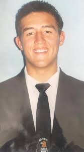 Before the nose jobs