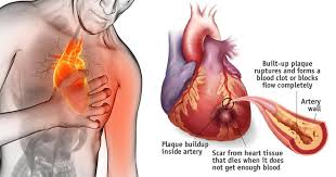 Pin On Health Fitness
