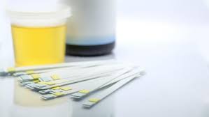 Selama ini, air kencing saya berwarna normal. Ragam Warna Urine Dan Artinya Bagi Kesehatan Tubuh
