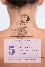 Find best laser resurfacing for scars & laser treatment for tattoo removal in ca for men & women. Laser Tattoo Removal Aftercare Easy Tips From Infinity Laser Spa Nyc Laser Tattoo Removal Laser Tattoo Tattoo Removal