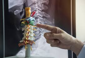 On doit aussi se rendre compte des problèmes actuels du chômages pour que la profession choisie permette d'être embauché. Mal Au Cou Dans Quelle Position Dormir Reflex Osteo
