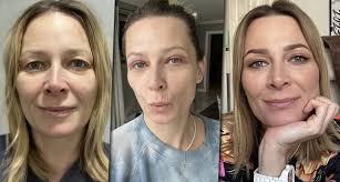 Kobiety robią to, by wyszczuplić szyję. Barbie botox: popularny na TikToku  i groźny