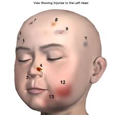 Murdered toddler was not protected from killers