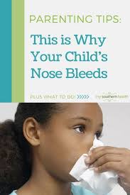 What To Do For A Nose Bleed My Southern Health Nose Bleeds Bleeding Nose Remedies Stop Nose Bleeds
