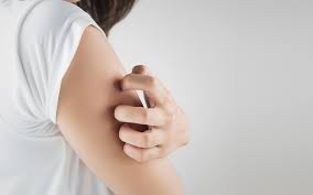 Cara menghilangkan gatal di selangkangan dengan alami. 5 Cara Menghilangkan Gatal Gatal Di Badan Jagoan Kode