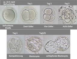 Die embryonen implantieren sich am sechsten oder siebten tag der entwicklung, d.h. Ablauf Der Kunstlichen Befruchtung Kinderwunsch At