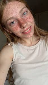 Most people make jokes about my skin. You too?