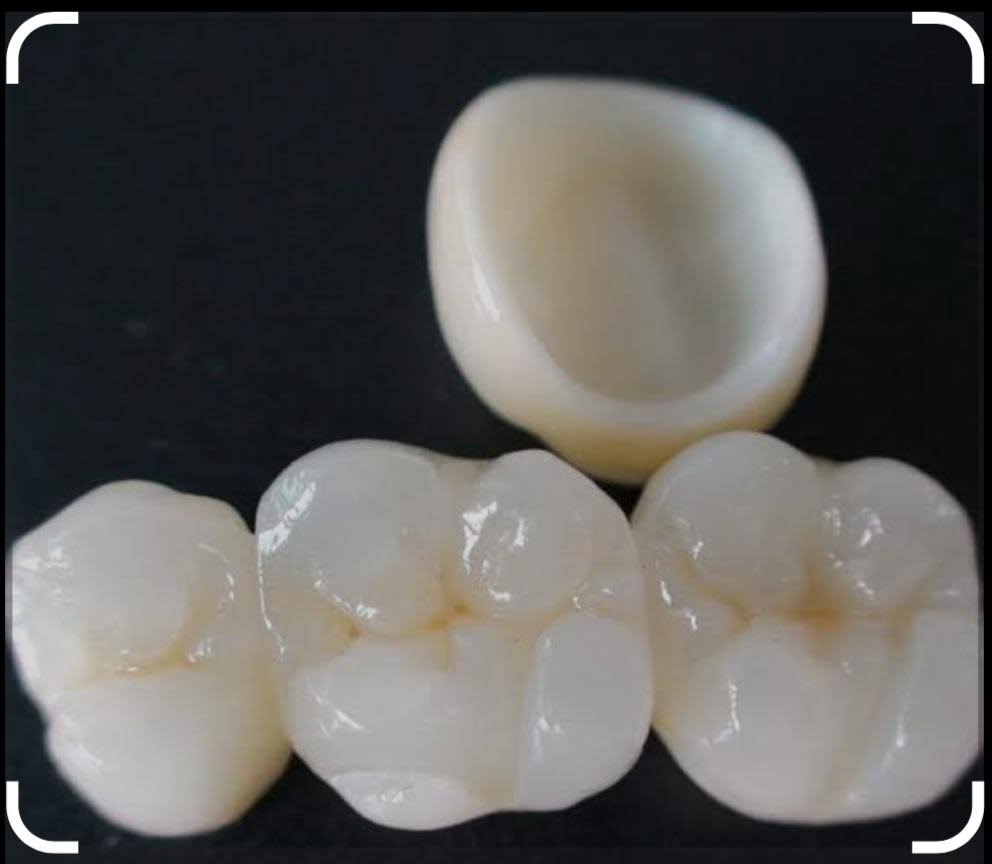 ZIRCONIA CROWNS product image