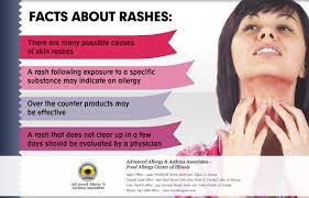 Pin On Allergy Asthma Tips Illinois