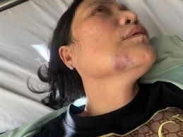 Gia Lai: Yêu cầu xử lý nhóm hành hung nhân viên y tế