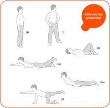 Ankylosing Spondylitis Should You Be Concerned St Albert Physiotherapy