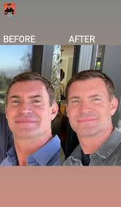 600 x 449 jpeg 27 кб. Jeff Lewis Shares Before And After Shot Of Eye Surgery Results People Com