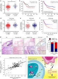Bladder cancer is the fourth most common cancer in males, but it can also affect females. Lnmat1 Promotes Lymphatic Metastasis Of Bladder Cancer Via Ccl2 Dependent Macrophage Recruitment Nature Communications