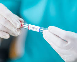 К тому же на ранних сроках болезни вероятность получения. áˆ Test Na Koronavirus Na Domu Pcr Test Doma V Kieve Cena Klinika Dobrobut