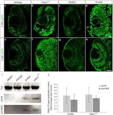 Eşti pe cale să postezi un mesaj care poate încuraja pirateria şi distribuţia ilegală de materiale pe internet. Redox Signaling Via Lipid Peroxidation Regulates Retinal Progenitor Cell Differentiation Biorxiv