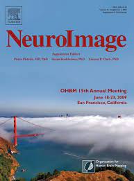 Boris the chinchilla 49 ; Ohbm 15th Annual Meeting Organization For Human Brain Mapping