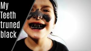 All right reserved for castrol ! This Toothpaste Made My Teeth Black Blackout Challenge Youtube