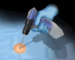 Image result for Bone Marrow Exam