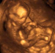 We have many mothers who come to have this amazing 3d/4d ultrasound service performed without determining gender and still keeping. Gender Scan Only 60 99 Accurate No 1 Uk Pregnancy Scan Experts