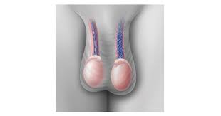 Image result for Varicocele